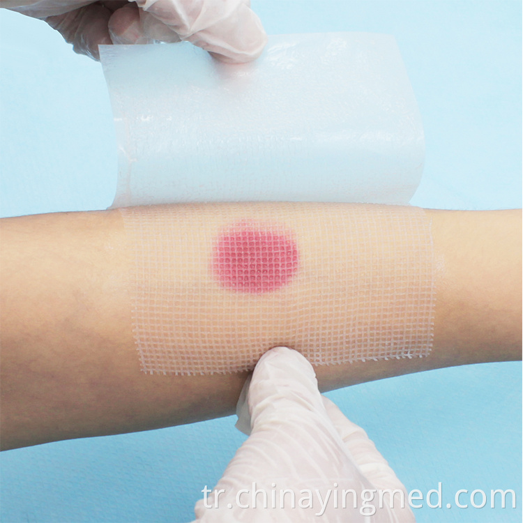 Parafin gazlı bez pansuman (5) Paraffin gauze dressing (5)